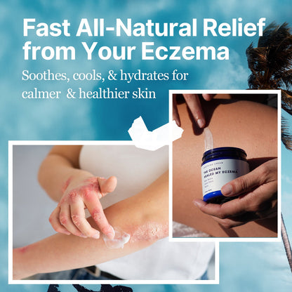 The Ocean Healed My Eczema™  - Flikan