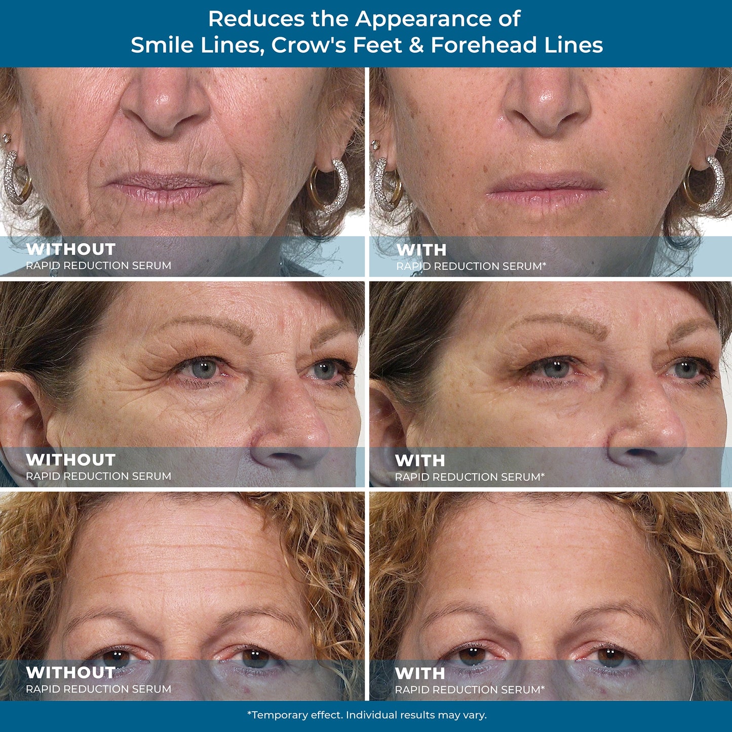 Flikan Rapid Reduction Serum
